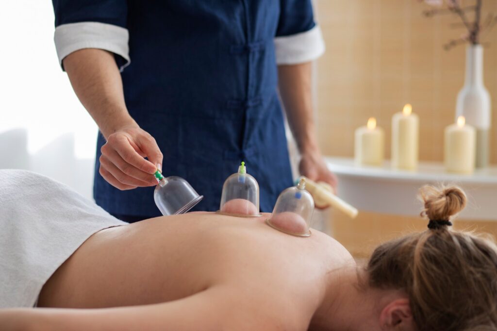 Cupping Therapy on the Rise: Exploring Its Benefits and Popularity